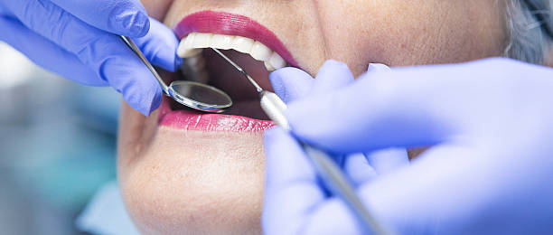 Best Urgent Care for Lost Fillings or Crowns in Spring Valley, IL